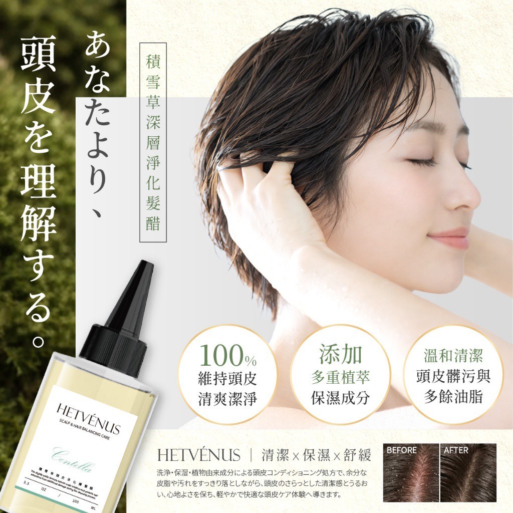 HETVÉNUS® 積雪草頭皮深層淨化護髮醋100ml 需沖洗